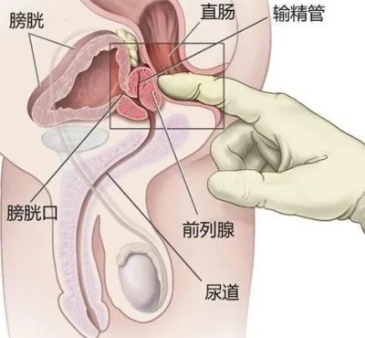 【Prostate Stimulation】Discover a New Form of Male Orgasm and Explore the Mysterious Prostate